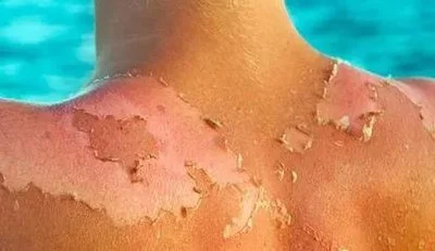 blog-400-231 blog-400-231