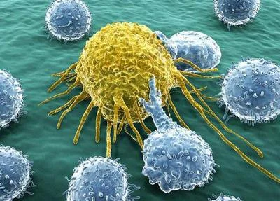 blog-400-287 blog-400-287