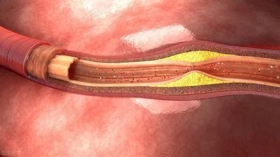 blog-400-225 blog-400-225