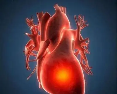 blog-400-321 blog-400-321