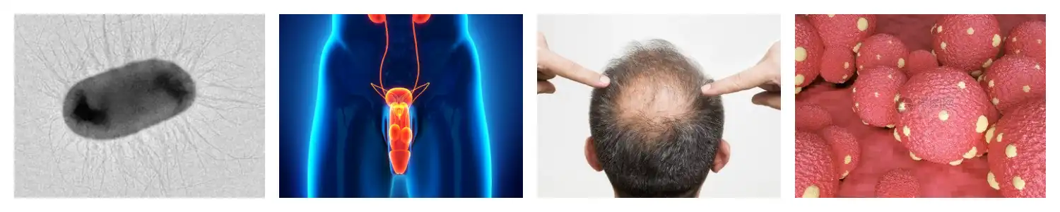 product-1-1 product-1-1