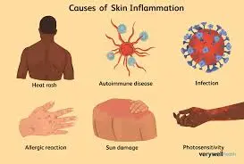 blog-273-184 blog-273-184