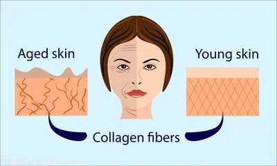 blog-400-240 blog-400-240