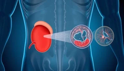 blog-400-229 blog-400-229