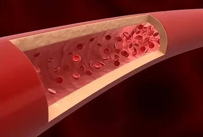 blog-400-270 blog-400-270