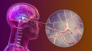 blog-300-168 blog-300-168