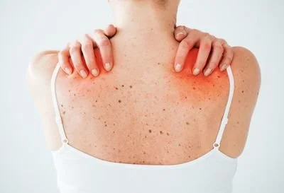 blog-400-273 blog-400-273