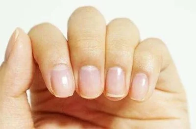 blog-400-263 blog-400-263