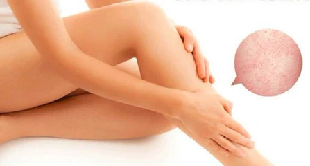 blog-447-240 blog-447-240