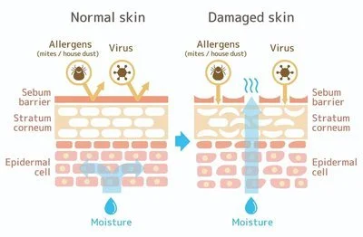 blog-400-262 blog-400-262