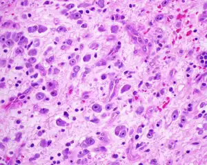 blog-300-240 blog-300-240