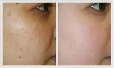 blog-400-240 blog-400-240