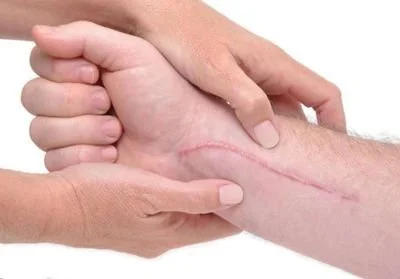 blog-400-279 blog-400-279