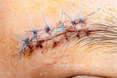 blog-400-265 blog-400-265