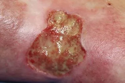 blog-400-266 blog-400-266