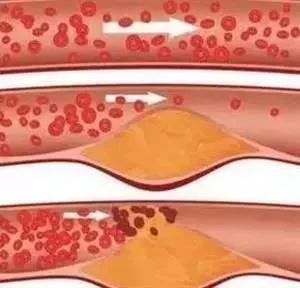 blog-300-288 blog-300-288