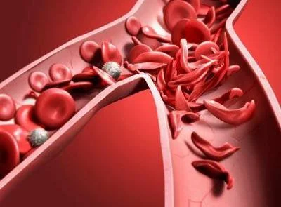 blog-400-295 blog-400-295