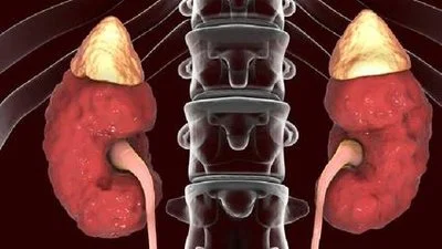 blog-400-225 blog-400-225