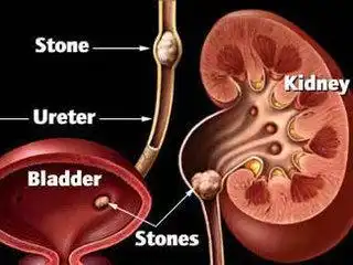 blog-320-240 blog-320-240