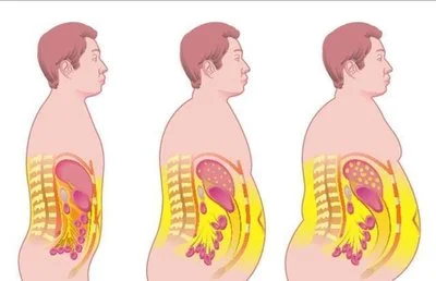 blog-400-258 blog-400-258