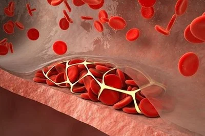 blog-400-266 blog-400-266